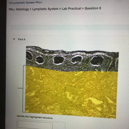 PLS HELP 
PAL: Histology > Lymphatic System > Lab Practical > Question 8